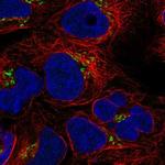 BLOC1S3 Antibody in Immunocytochemistry (ICC/IF)