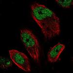 C11orf30 Antibody in Immunocytochemistry (ICC/IF)