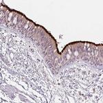 SPACA9 Antibody in Immunohistochemistry (IHC)