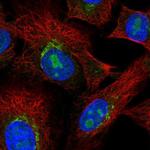 PDGFRL Antibody in Immunocytochemistry (ICC/IF)