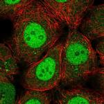 RFXANK Antibody in Immunocytochemistry (ICC/IF)