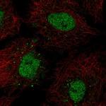 BarX1 Antibody in Immunocytochemistry (ICC/IF)