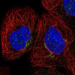 CYBRD1 Antibody in Immunocytochemistry (ICC/IF)