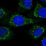 KCTD18 Antibody in Immunocytochemistry (ICC/IF)