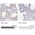 OIP5 Antibody in Immunohistochemistry (IHC)