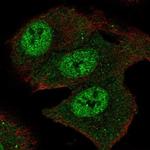 SMOX Antibody in Immunocytochemistry (ICC/IF)