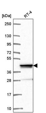 ZNF618 Antibody in Western Blot (WB)