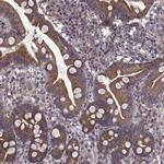 PMM2 Antibody in Immunohistochemistry (IHC)