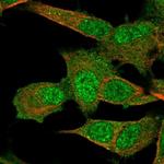 PMM2 Antibody in Immunocytochemistry (ICC/IF)