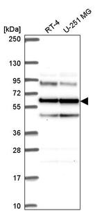 Seryl-tRNA synthetase Antibody in Western Blot (WB)
