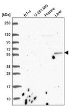 CDK5RAP1 Antibody in Western Blot (WB)