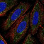 TTPAL Antibody in Immunocytochemistry (ICC/IF)