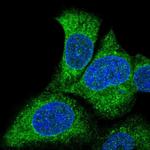 SLC27A3 Antibody in Immunocytochemistry (ICC/IF)