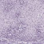 ZNF865 Antibody in Immunohistochemistry (IHC)