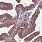 WARS2 Antibody in Immunohistochemistry (IHC)