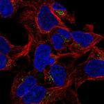 GALNT8 Antibody in Immunocytochemistry (ICC/IF)