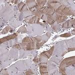 YIPF5 Antibody in Immunohistochemistry (IHC)