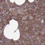 YIPF5 Antibody in Immunohistochemistry (IHC)