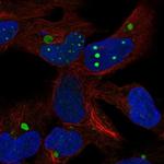 HEY2 Antibody in Immunocytochemistry (ICC/IF)