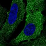 KRT75 Antibody in Immunocytochemistry (ICC/IF)