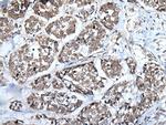 WEE1 Antibody in Immunohistochemistry (Paraffin) (IHC (P))