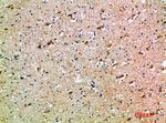 Oncostatin M Antibody in Immunohistochemistry (Paraffin) (IHC (P))