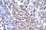 ERCC8 Antibody in Immunohistochemistry (IHC)