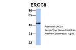 ERCC8 Antibody in Western Blot (WB)