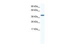 ZFP36L1 Antibody in Western Blot (WB)