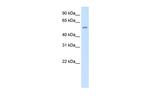 THRB Antibody in Western Blot (WB)