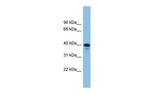 TSC22D4 Antibody in Western Blot (WB)