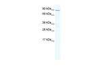 ZHX2 Antibody in Western Blot (WB)