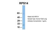 RPS14 Antibody in Western Blot (WB)