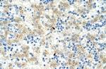 EXOSC6 Antibody in Immunohistochemistry (Paraffin) (IHC (P))