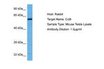 TCP-1 theta Antibody in Western Blot (WB)