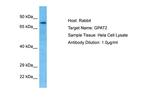 GPAT2 Antibody in Western Blot (WB)