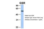 GSR Antibody in Western Blot (WB)