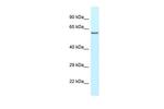 HABP2 Antibody in Western Blot (WB)