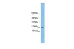 TRAPPC1 Antibody in Western Blot (WB)