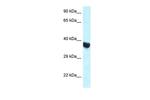 HOXA11 Antibody in Western Blot (WB)