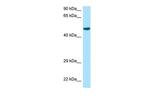 RCC1 Antibody in Western Blot (WB)