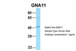 GNA11 Antibody in Western Blot (WB)