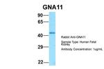 GNA11 Antibody in Western Blot (WB)