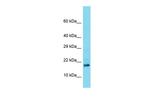 TDRP Antibody in Western Blot (WB)