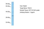 TSGA10 Antibody in Western Blot (WB)