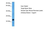 MRAS Antibody in Western Blot (WB)