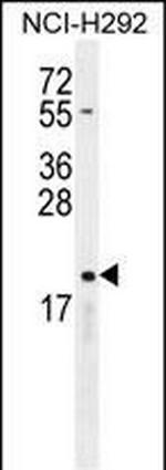 CYBA Antibody in Western Blot (WB)