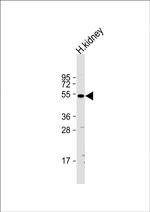 CLEC18A Antibody in Western Blot (WB)