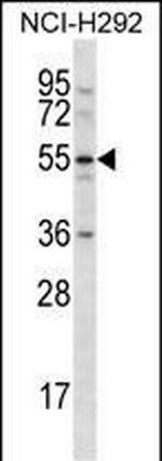 CLEC18A Antibody in Western Blot (WB)