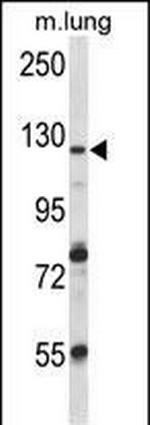 VPS54 Antibody in Western Blot (WB)